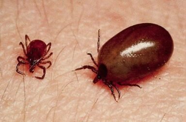 Scrub Typhus Sundargarh