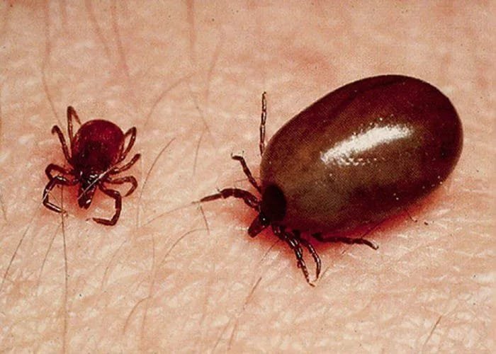 Scrub Typhus Sundargarh