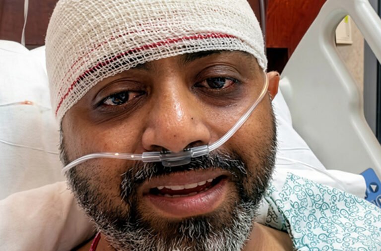 Captain Smith is recovering.